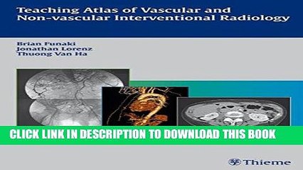 [READ] EBOOK Teaching Atlas of Vascular and Non-vascular Interventional Radiology BEST COLLECTION