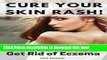 [PDF] Cure Your Skin Rash! The Best Secrets to Get Rid of Eczema, Itch, and Skin Allergies. Full
