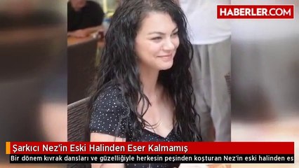 Şarkıcı Nez'in Eski Halinden Eser Kalmamış