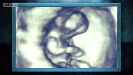 10 rzeczy, które wyrosły wewnątrz ludzi [TOPOWA DYCHA]