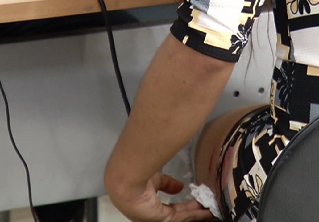 Una persona agredida con palos y pico de botella