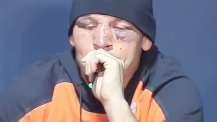 Nate Diaz Under Investigation For Violating UFC Doping Policy