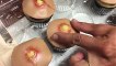 Cupcakes en forme de boutons d'acné