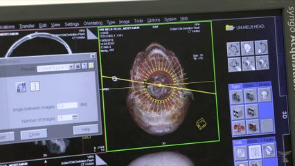 Últimas tecnologías devuelven la vida a una momia