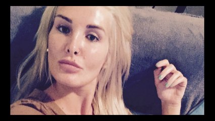 #SS10 : Marie Garet aurait-elle succombé à la chirurgie esthétique ?