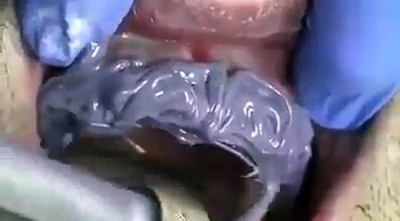 teeth gum amazing