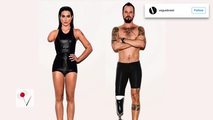 Vogue Brazil Under Fire for Photoshopping Models to Look Disabled