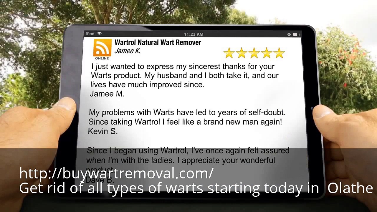 Where Can I Buy Wart Remover in Olathe KS