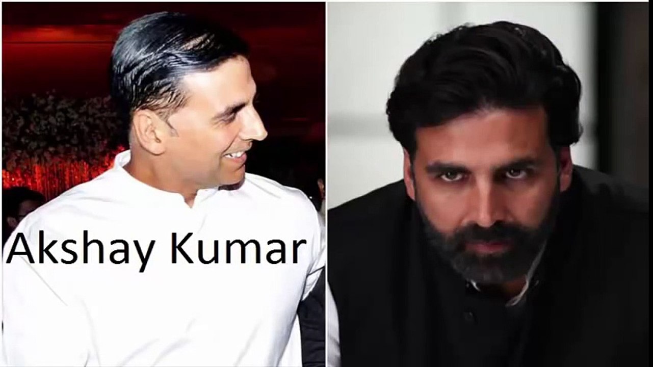 Hair transplantation_before and after_famous bollywood actors_govinda__sanjay du
