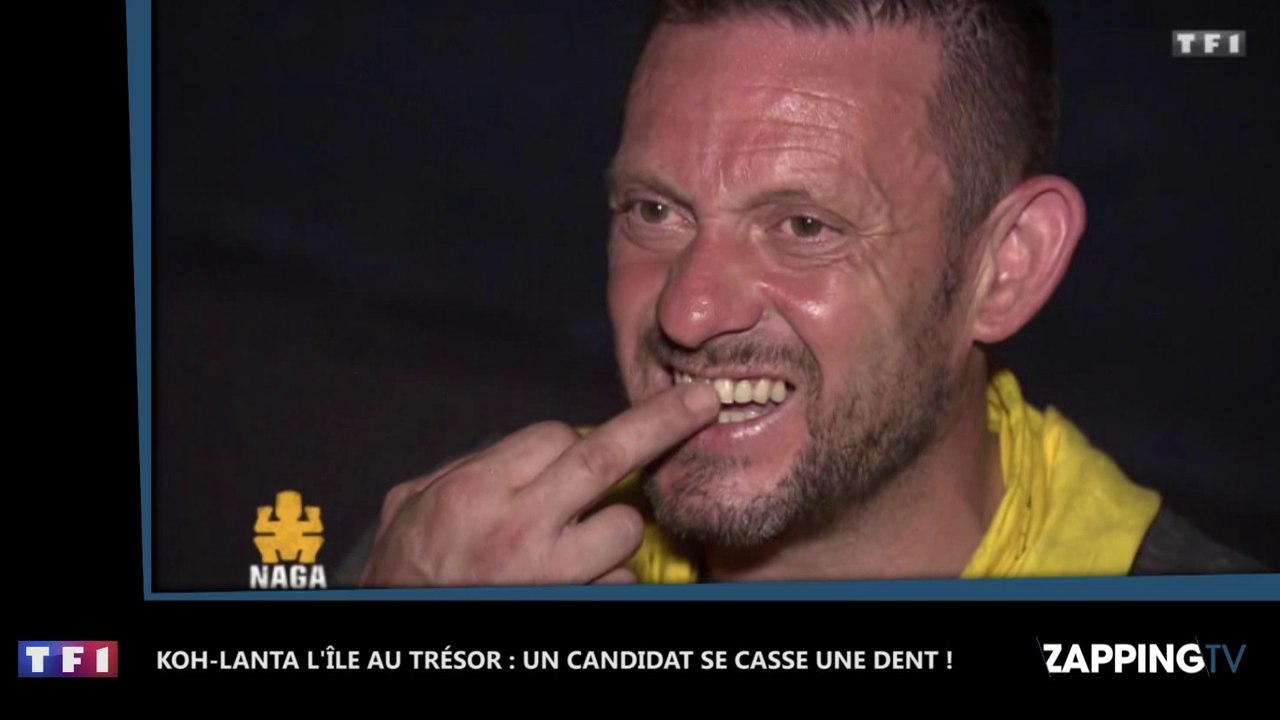 Koh-Lanta, l’île au trésor : Jérôme se casse une dent en mangeant une noix de coco ! (Vidéo)