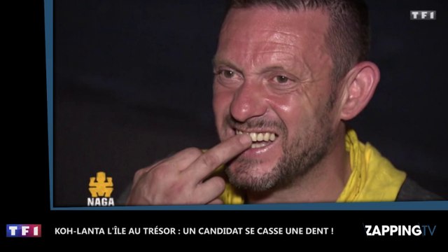 Koh-Lanta, l’île au trésor : Jérôme se casse une dent en mangeant une noix de coco ! (Vidéo)