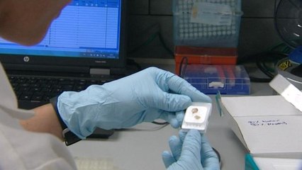 Test epigenético permite tratamientos específicos en cánceres de origen desconocidos