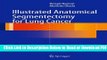 [Download] Illustrated Anatomical Segmentectomy for Lung Cancer Popular New