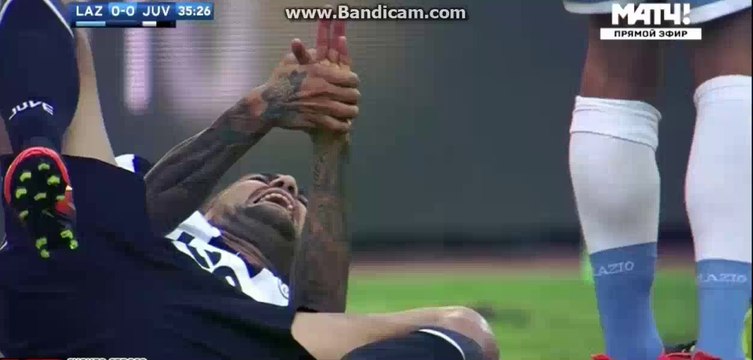Dani Alves Brocken Finger - Lazio 0-0 Juventus - 27-08-2016