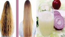 Onion and hair growth - How to use onion juice the right way to prevent hair loss