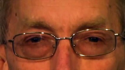 Upper Facial Chorea in Patients with Huntington's disease