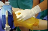 Selhání anestezie- Operace zaživa -dokument (www.Dokumenty.TV)