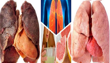 How to Clean Your Lungs In 3 Days