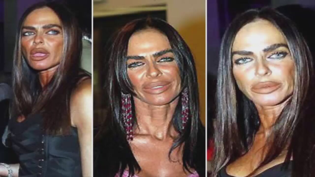 13 ünlüden 13 estetik faciası