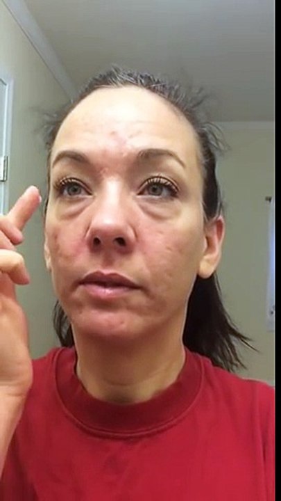 Instantly Ageless