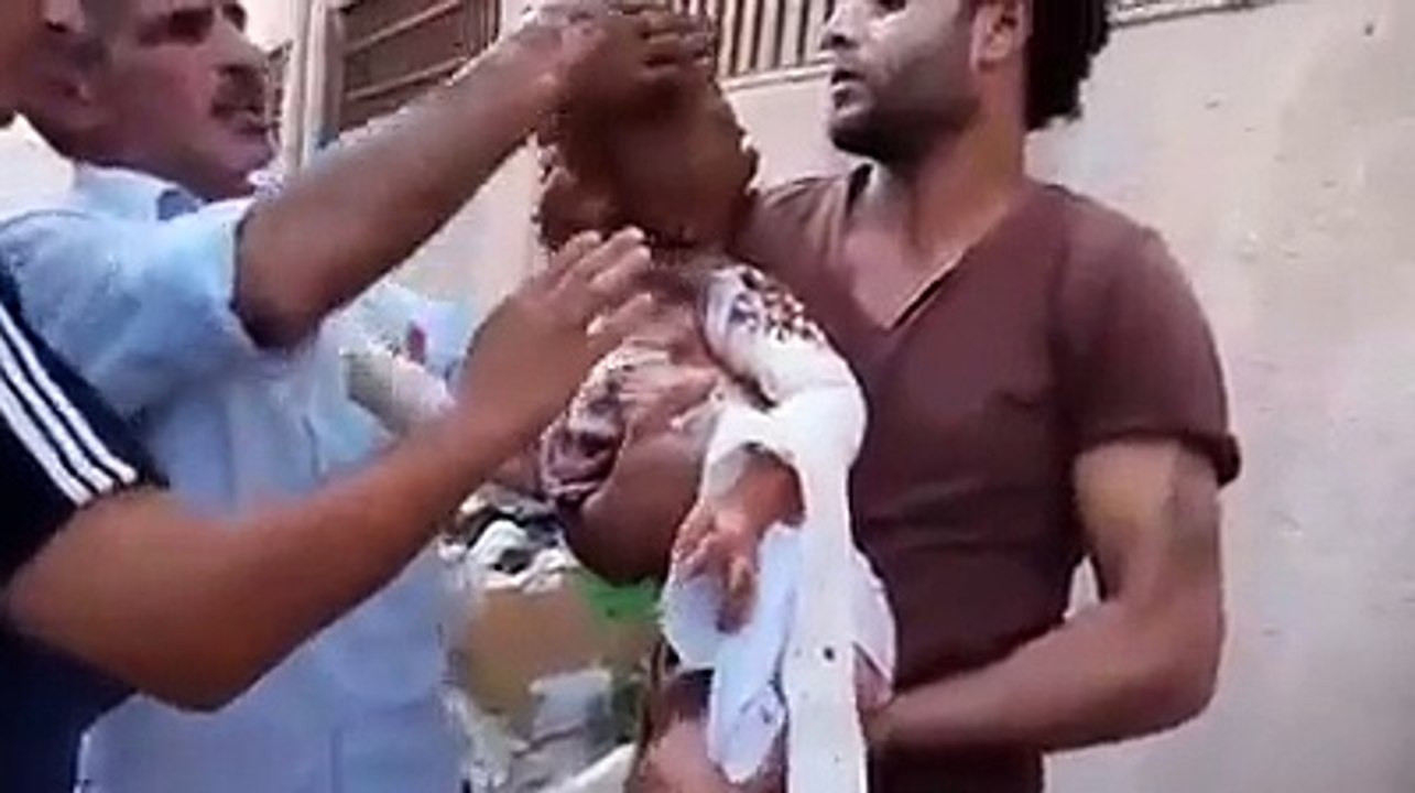 Suriyeli çocuklar 'napalm bombası' ile vuruluyor.