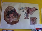 Mesečno se u Boru abortusom prekine i do 30 trudnoća, 30. avgust 2016. (RTV Bor)