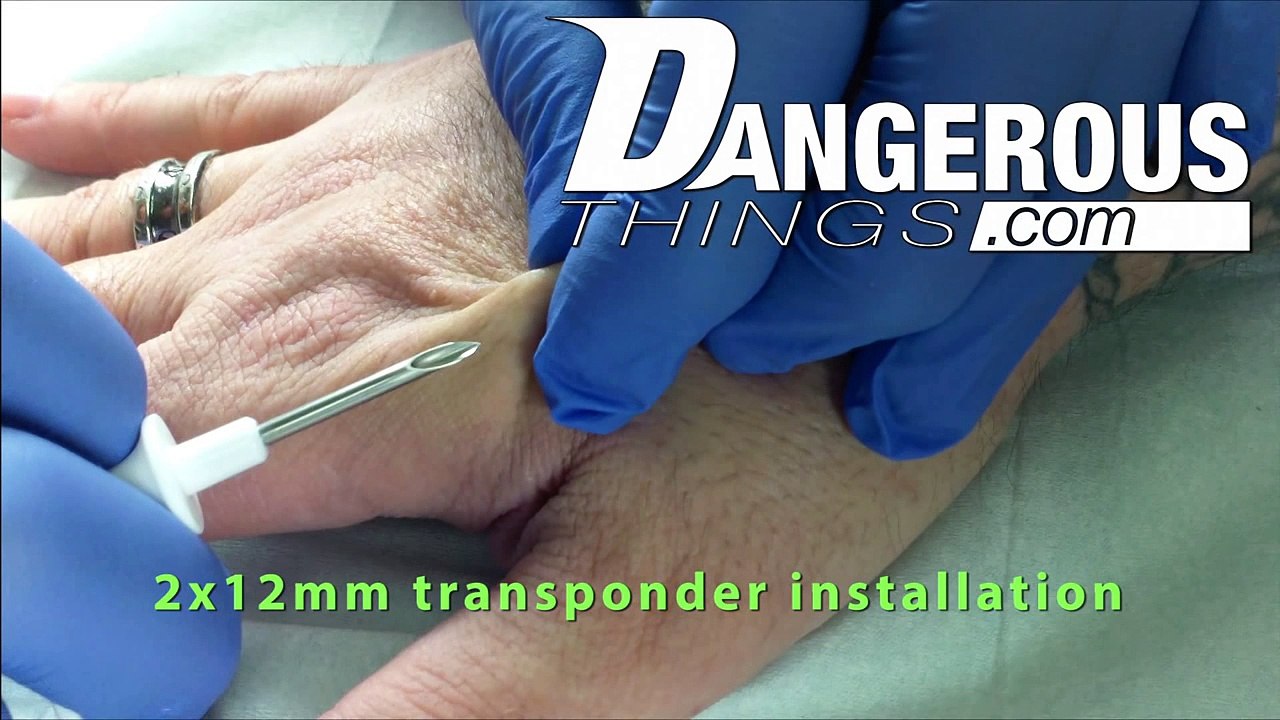 Implant NFC