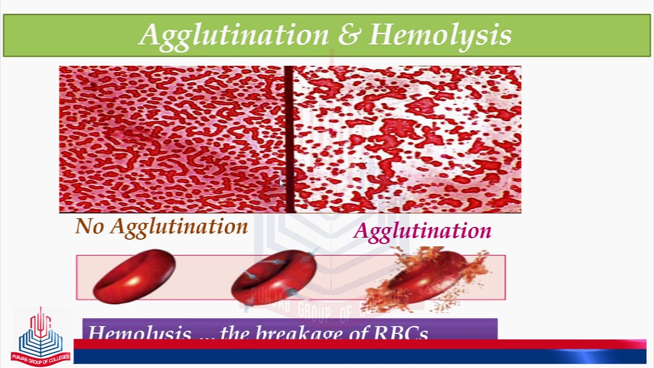 Blood Group & Serum Antibodies