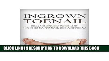 [PDF] Foot Pain: Ingrown Toenail: How To Become Stress Free And Easily Cure This Nasty Nail