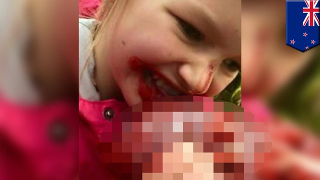 【閲覧注意】鹿の心臓食べる娘の写真を投稿　父親に批判殺到するも…