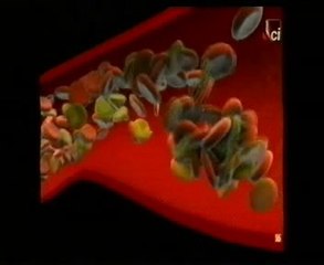 Anticonceptivos orales y tabaquismo: Autopsia forense