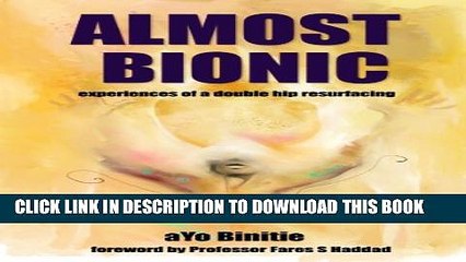 [PDF] Almost Bionic, experiences of a double hip resurfacing Popular Online