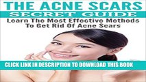 [PDF] The Acne Scars Secret Guide: Learn The Most Effective Methods To Get Rid Of Acne Scars (Acne