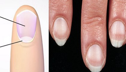 5 Things Your Nails Can Say About Your Health
