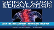 [PDF] Spinal Cord Stimulation Implantation: Percutaneous Implantation Techniques Popular Online