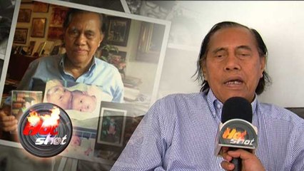 Kisah Kembar Siam di Dunia - Hot Shot 03 September 2016