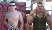 Brazilian Man Nearly Lost His Arms Thanks to Horrifying Side Effects Of Muscle Supplements