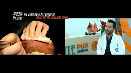Jo vetem mode - Metoda "FUE" per transplant flokesh ne Sante Plus! (21 maj 2016)