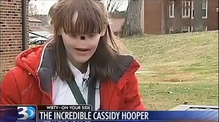 Une fille née sans nez