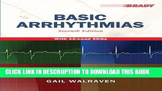 [PDF] Basic Arrhythmias, 7th Edition Popular Online