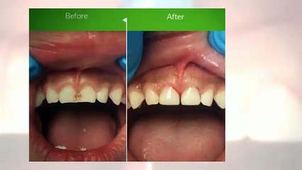 Sandy Springs Childrens Dentist