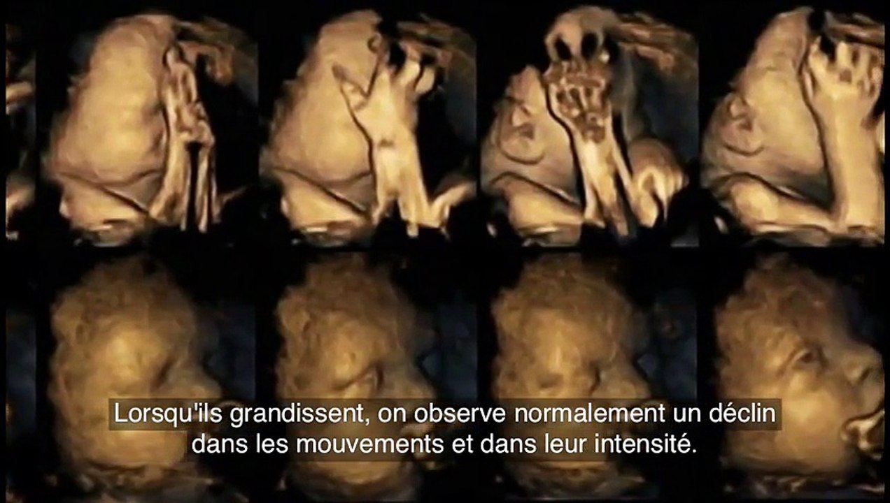 Les résultats incroyables de la différence entre le foetus d'une femme enceinte fumeuse et celui d'une non-fumeuse
