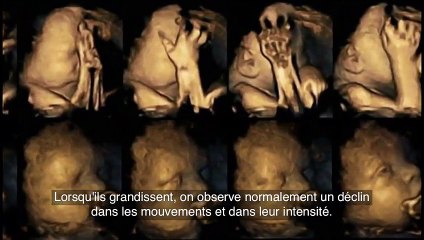 Les résultats incroyables de la différence entre le foetus d'une femme enceinte fumeuse et celui d'une non-fumeuse