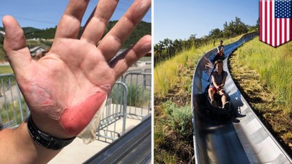 Father and son get second, third degree burns from theme park ride