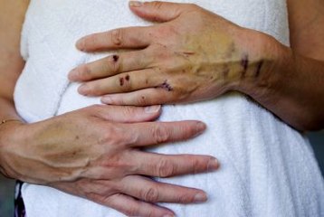 İngiltere'de Kadına Yönelik Şiddet Suçları En Yüksek Seviyesinde