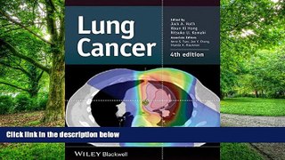 Big Deals  Lung Cancer  Best Seller Books Best Seller