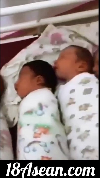Astonishing Footage of Twin Babies  Don't Know They've Been Born Yet! Must See!