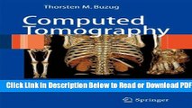 [Download] Computed Tomography: From Photon Statistics to Modern Cone-Beam CT Free Online