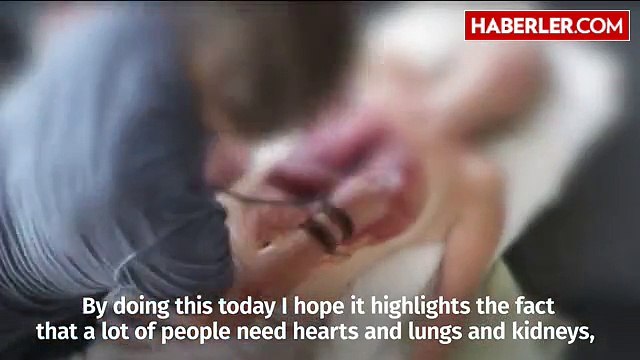 Organ Bağışına Dikkat Çekmek İçin Soyundu