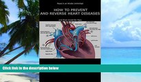 Must Have PDF  HOW TO PREVENT AND REVERSE HEART DISEASES: and Even Avoid By-Pass (HEALTH SERIES